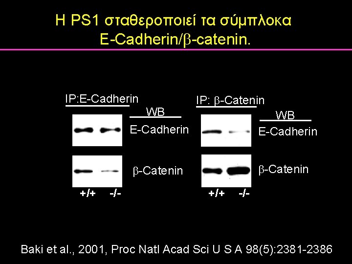 Η PS 1 σταθεροποιεί τα σύμπλοκα E-Cadherin/ -catenin. IP: E-Cadherin IP: -Catenin WB E-Cadherin Η PS 1 σταθεροποιεί τα σύμπλοκα E-Cadherin/ -catenin. IP: E-Cadherin IP: -Catenin WB E-Cadherin