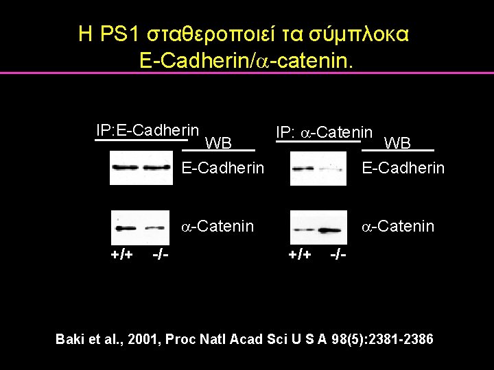 Η PS 1 σταθεροποιεί τα σύμπλοκα E-Cadherin/ -catenin. IP: E-Cadherin IP: -Catenin WB E-Cadherin Η PS 1 σταθεροποιεί τα σύμπλοκα E-Cadherin/ -catenin. IP: E-Cadherin IP: -Catenin WB E-Cadherin