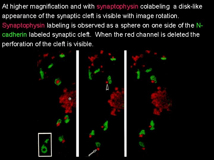 At higher magnification and with synaptophysin colabeling a disk-like appearance of the synaptic cleft At higher magnification and with synaptophysin colabeling a disk-like appearance of the synaptic cleft