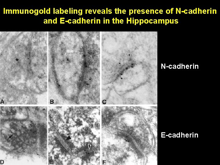 Immunogold labeling reveals the presence of N-cadherin and E-cadherin in the Hippocampus N-cadherin E-cadherin Immunogold labeling reveals the presence of N-cadherin and E-cadherin in the Hippocampus N-cadherin E-cadherin