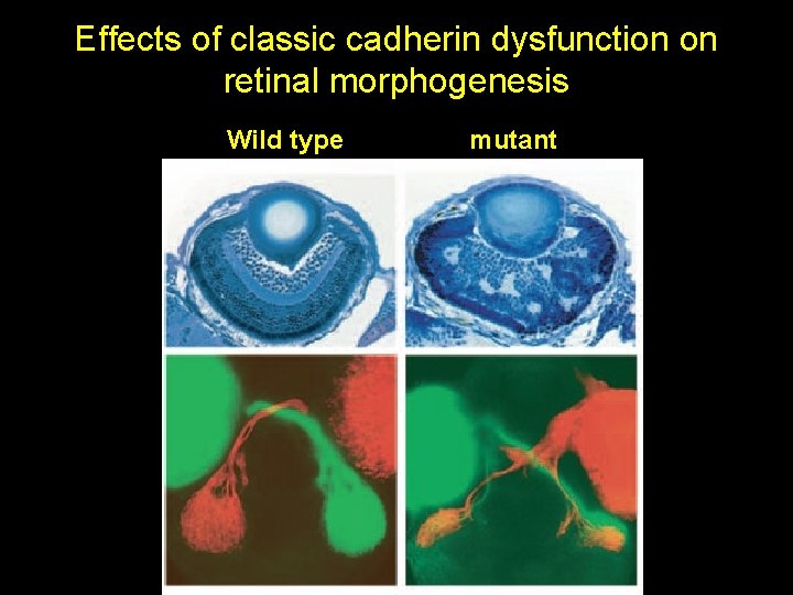 Effects of classic cadherin dysfunction on retinal morphogenesis Wild type mutant Effects of classic cadherin dysfunction on retinal morphogenesis Wild type mutant