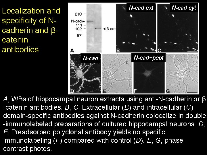 N-cad ext Localization and specificity of Ncadherin and βcatenin antibodies N-cad cyt N-cad+pept A, N-cad ext Localization and specificity of Ncadherin and βcatenin antibodies N-cad cyt N-cad+pept A,