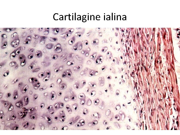 Cartilagine ialina 