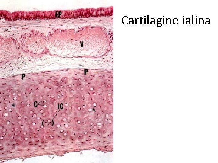 Cartilagine ialina 