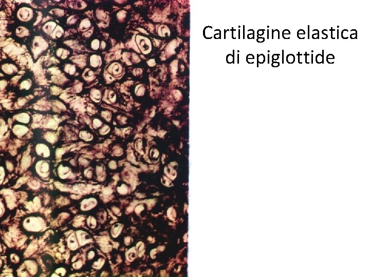 Cartilagine elastica di epiglottide 