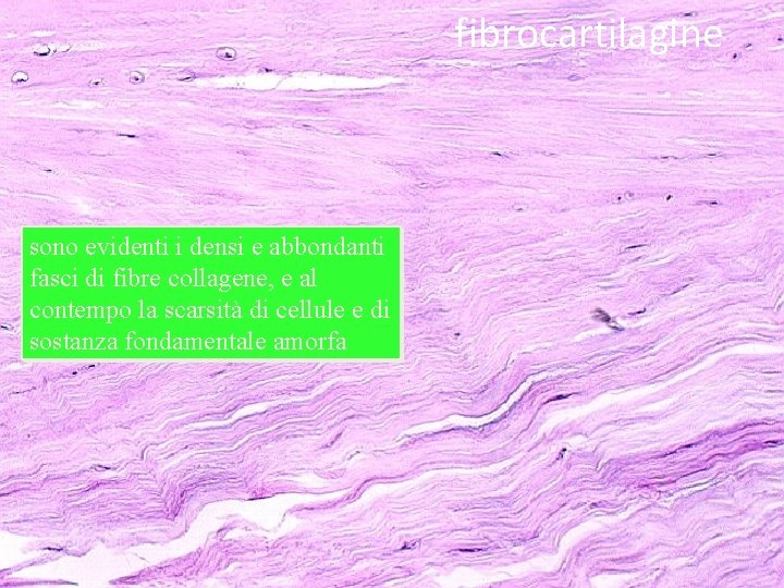 fibrocartilagine sono evidenti i densi e abbondanti fasci di fibre collagene, e al contempo