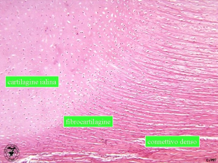 Transizione ialina…fibrosa…connettivo denso cartilagine ialina fibrocartilagine connettivo denso 
