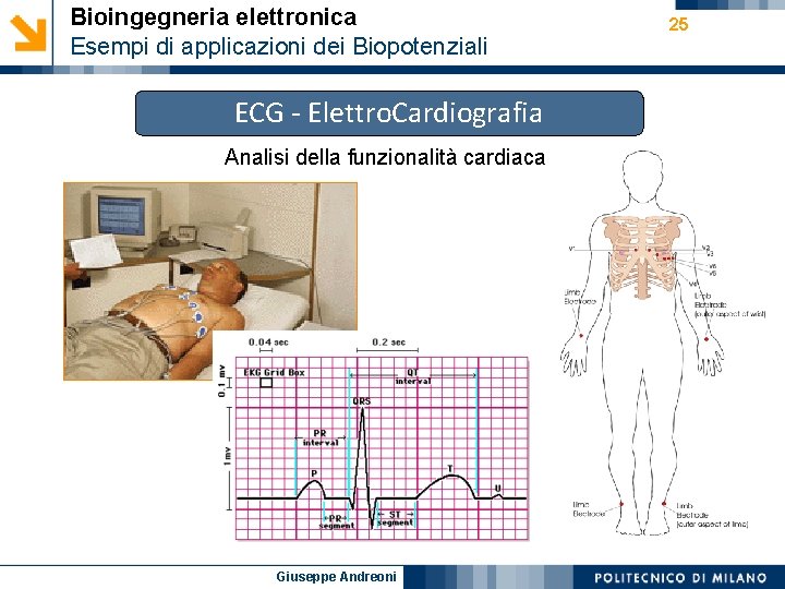 Bioingegneria elettronica Esempi di applicazioni dei Biopotenziali ECG - Elettro. Cardiografia Analisi della funzionalità