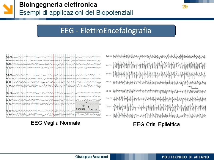 Bioingegneria elettronica Esempi di applicazioni dei Biopotenziali 29 EEG - Elettro. Encefalografia EEG Veglia