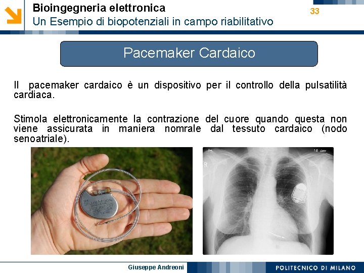 Bioingegneria elettronica Un Esempio di biopotenziali in campo riabilitativo 33 Pacemaker Cardaico Il pacemaker