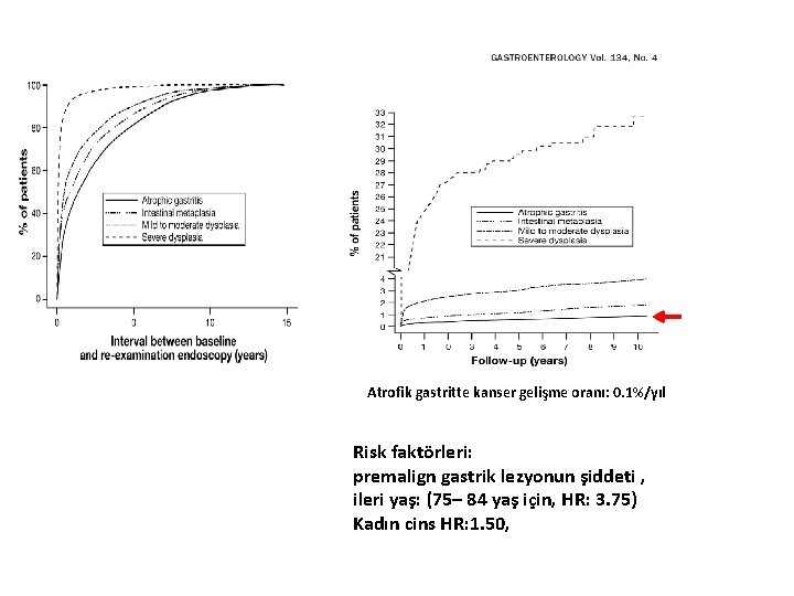 Atrofik gastritte kanser gelişme oranı: 0. 1%/yıl Risk faktörleri: premalign gastrik lezyonun şiddeti ,