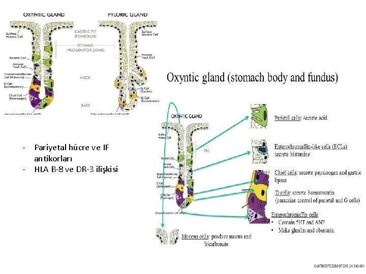 - Pariyetal hücre ve IF antikorları - HLA B-8 ve DR-3 ilişkisi 