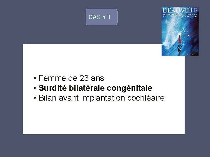 CAS n° 1 o • Femme de 23 ans. • Surdité bilatérale congénitale •