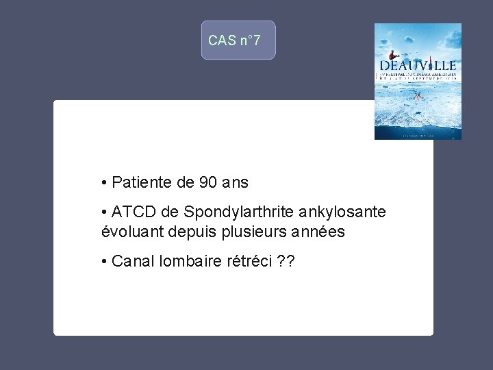 CAS n° 7 • Patiente de 90 ans o • ATCD de Spondylarthrite ankylosante CAS n° 7 • Patiente de 90 ans o • ATCD de Spondylarthrite ankylosante