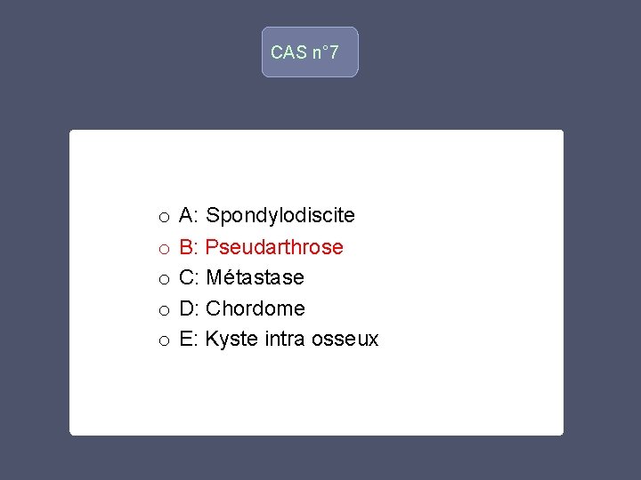 CAS n° 7 o o o A: Spondylodiscite B: Pseudarthrose C: Métastase D: Chordome