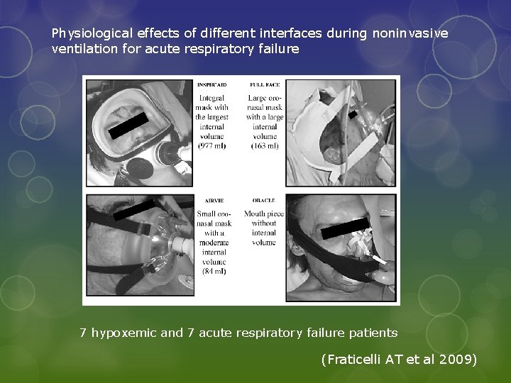 Physiological effects of different interfaces during noninvasive ventilation for acute respiratory failure 7 hypoxemic