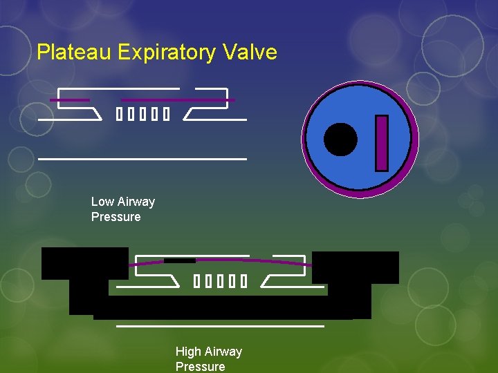 Plateau Expiratory Valve Low Airway Pressure High Airway Pressure 