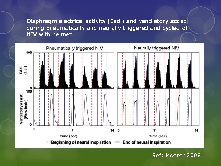 Diaphragm electrical activity (Eadi) and ventilatory assist during pneumatically and neurally triggered and cycled-off