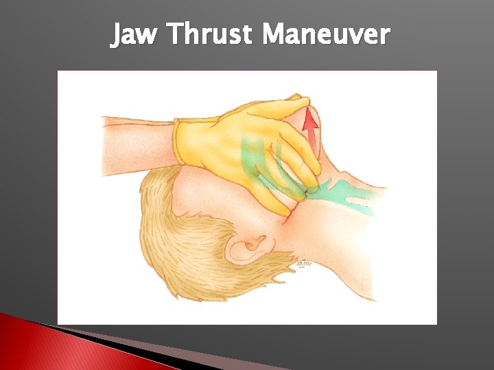 Jaw Thrust Maneuver 