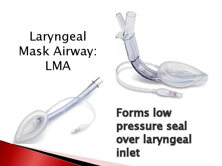 Laryngeal Mask Airway: LMA Forms low pressure seal over laryngeal inlet 