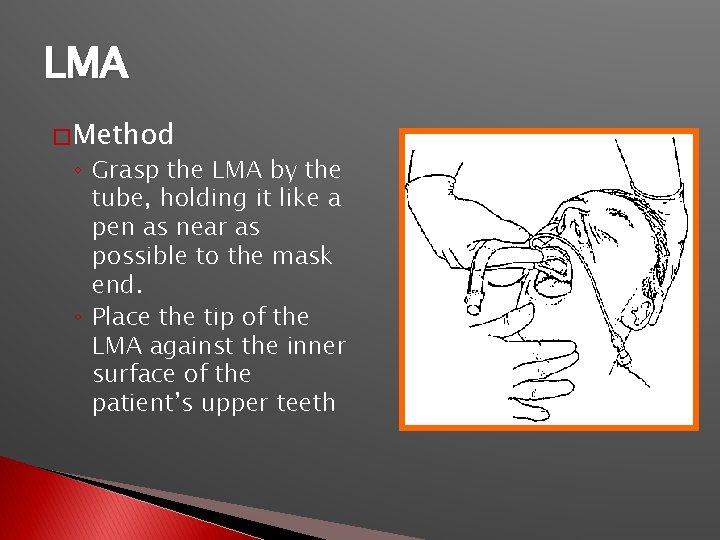 LMA � Method ◦ Grasp the LMA by the tube, holding it like a