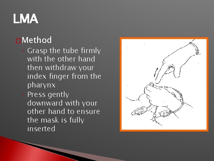 LMA � Method ◦ Grasp the tube firmly with the other hand then withdraw