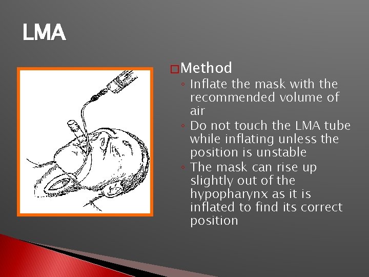 LMA � Method ◦ Inflate the mask with the recommended volume of air ◦