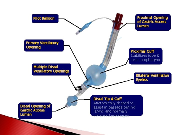 Proximal Opening of Gastric Access Lumen Pilot Balloon Primary Ventilatory Opening Proximal Cuff Stabilizes