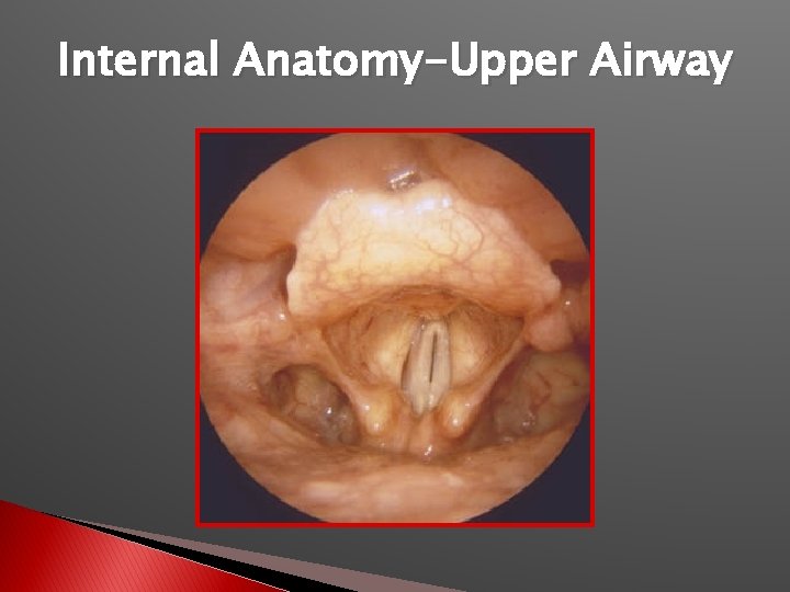 Internal Anatomy-Upper Airway 