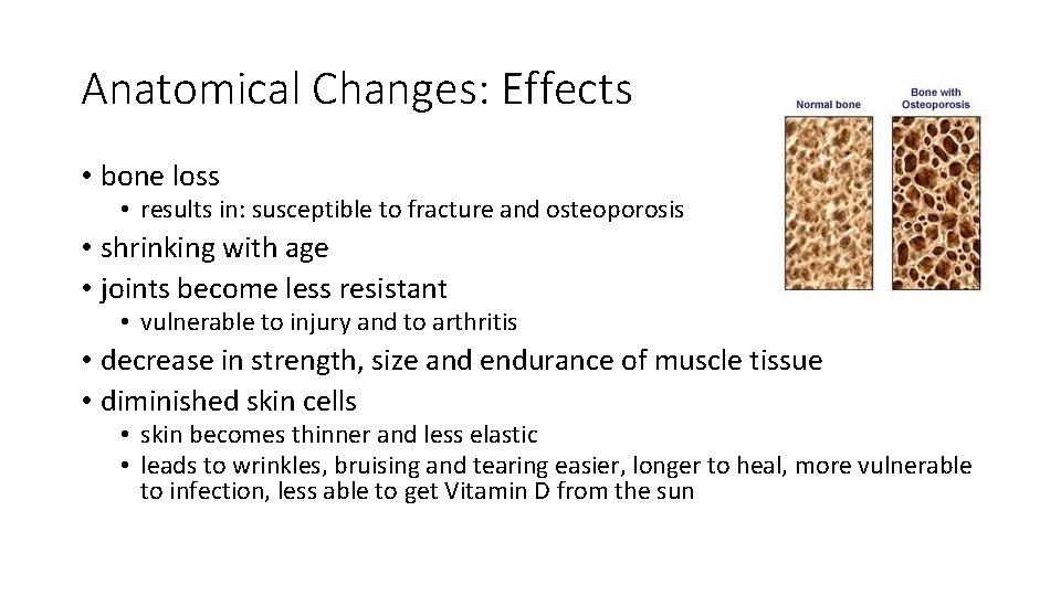 Anatomical Changes: Effects • bone loss • results in: susceptible to fracture and osteoporosis