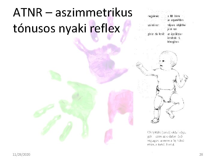 ATNR – aszimmetrikus tónusos nyaki reflex 11/28/2020 28 ATNR – aszimmetrikus tónusos nyaki reflex 11/28/2020 28