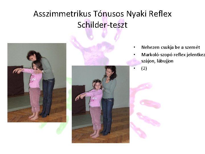 Asszimmetrikus Tónusos Nyaki Reflex Schilder-teszt • • • Nehezen csukja be a szemét Markoló-szopó Asszimmetrikus Tónusos Nyaki Reflex Schilder-teszt • • • Nehezen csukja be a szemét Markoló-szopó