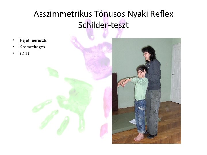 Asszimmetrikus Tónusos Nyaki Reflex Schilder-teszt • • • Fejét leereszti, Szemrebegés (2 -1) Asszimmetrikus Tónusos Nyaki Reflex Schilder-teszt • • • Fejét leereszti, Szemrebegés (2 -1)