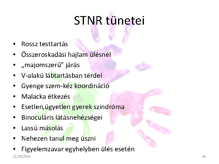 STNR tünetei • • • Rossz testtartás Összeroskadási hajlam ülésnél „majomszerű” járás V-alakú lábtartásban STNR tünetei • • • Rossz testtartás Összeroskadási hajlam ülésnél „majomszerű” járás V-alakú lábtartásban