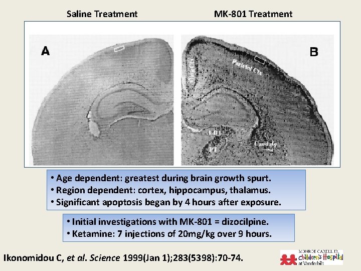 Saline Treatment MK-801 Treatment • Age dependent: greatest during brain growth spurt. • Region