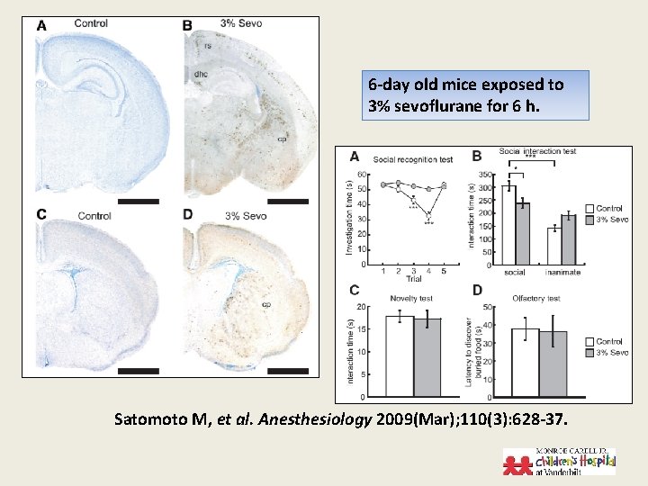 6 -day old mice exposed to 3% sevoflurane for 6 h. Satomoto M, et