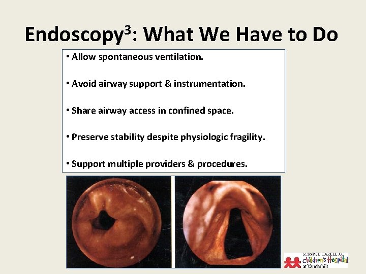 Endoscopy 3: What We Have to Do • Allow spontaneous ventilation. • Avoid airway