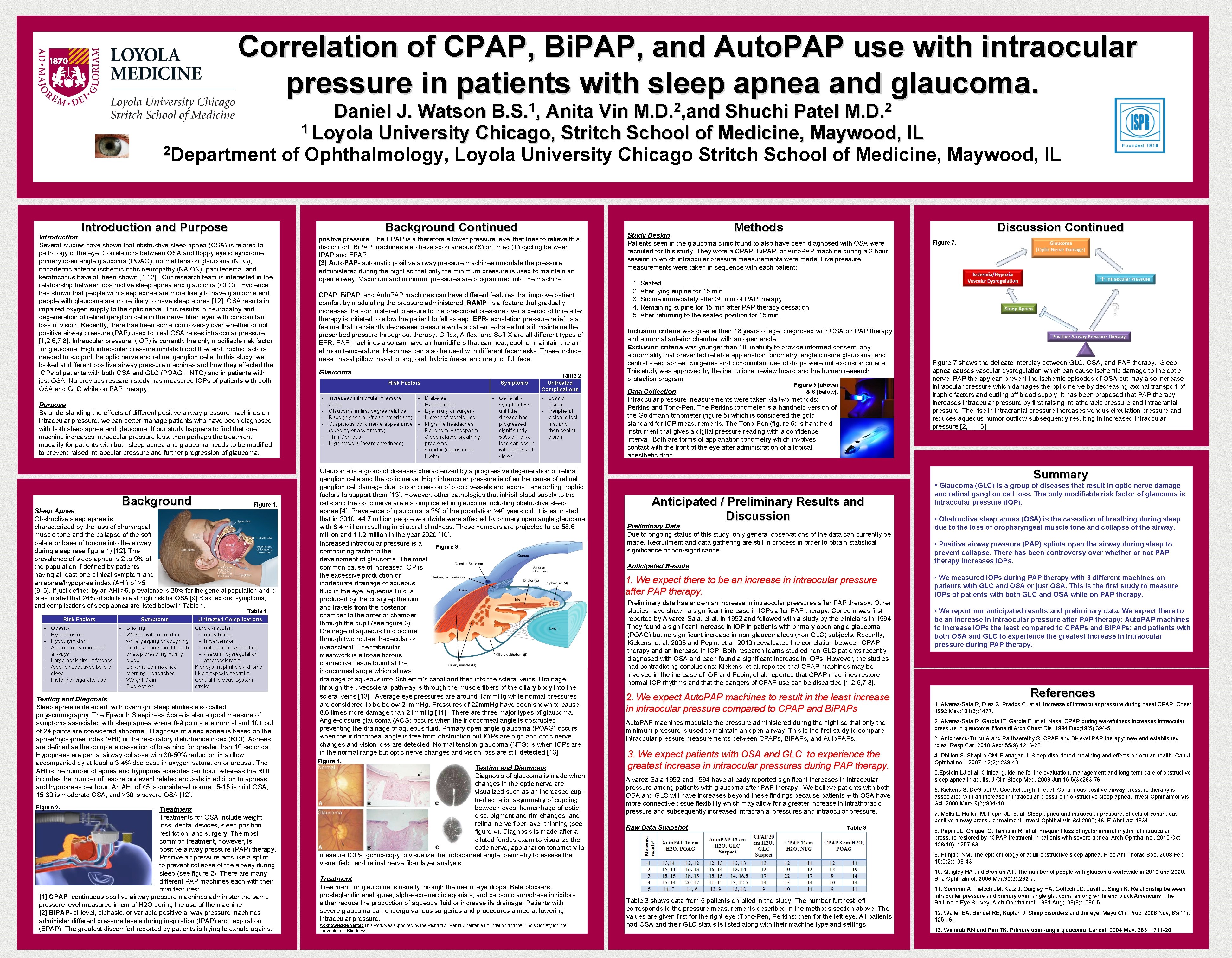 Correlation of CPAP, Bi. PAP, and Auto. PAP use with intraocular pressure in patients