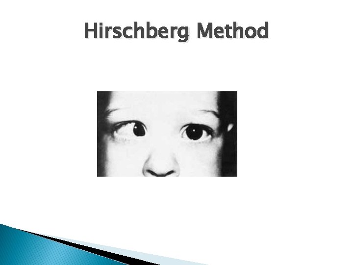 Hirschberg Method 