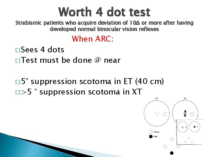 Worth 4 dot test Strabismic patients who acquire deviation of 10Δ or more after