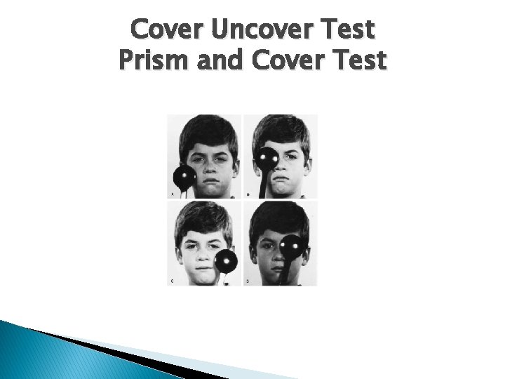 Cover Uncover Test Prism and Cover Test 