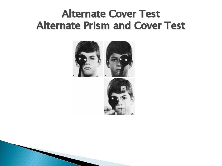 Alternate Cover Test Alternate Prism and Cover Test 