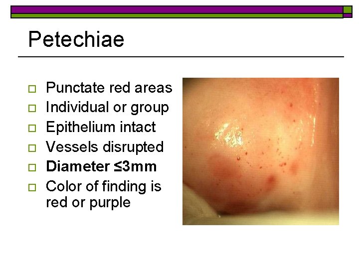 Petechiae o o o Punctate red areas Individual or group Epithelium intact Vessels disrupted