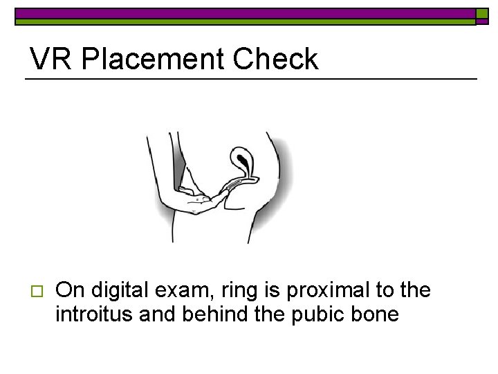 VR Placement Check o On digital exam, ring is proximal to the introitus and