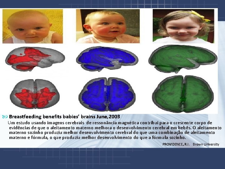  Breastfeeding benefits babies’ brains June, 2003 Um estudo usando imagens cerebrais de ressonância