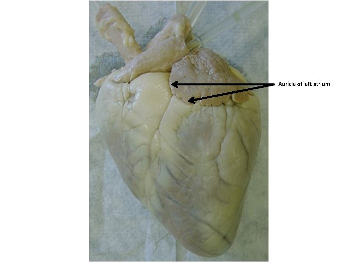 Auricle of left atrium 