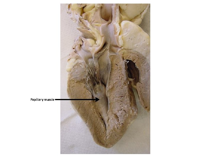 Papillary muscle 