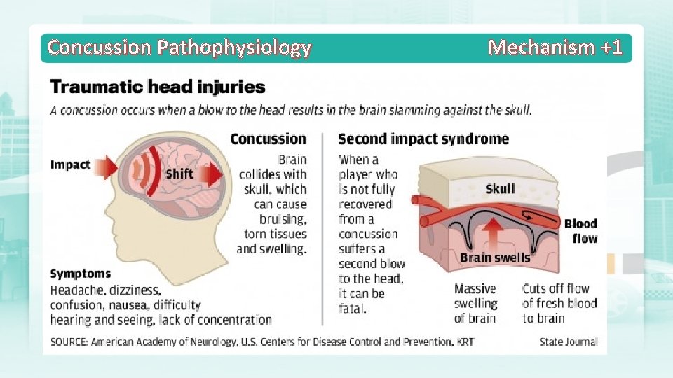 Concussion Pathophysiology Mechanism +1 