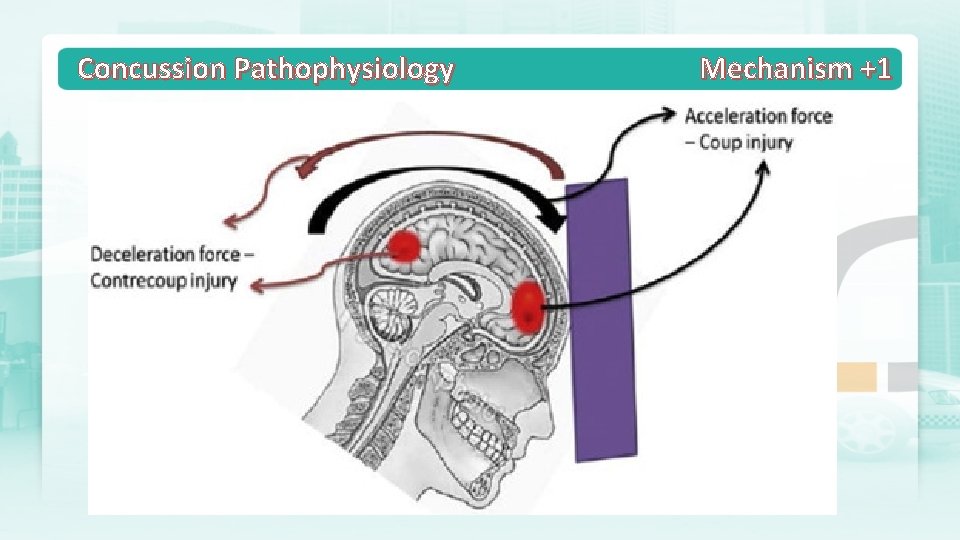 Concussion Pathophysiology Mechanism +1 