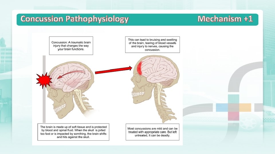 Concussion Pathophysiology Mechanism +1 